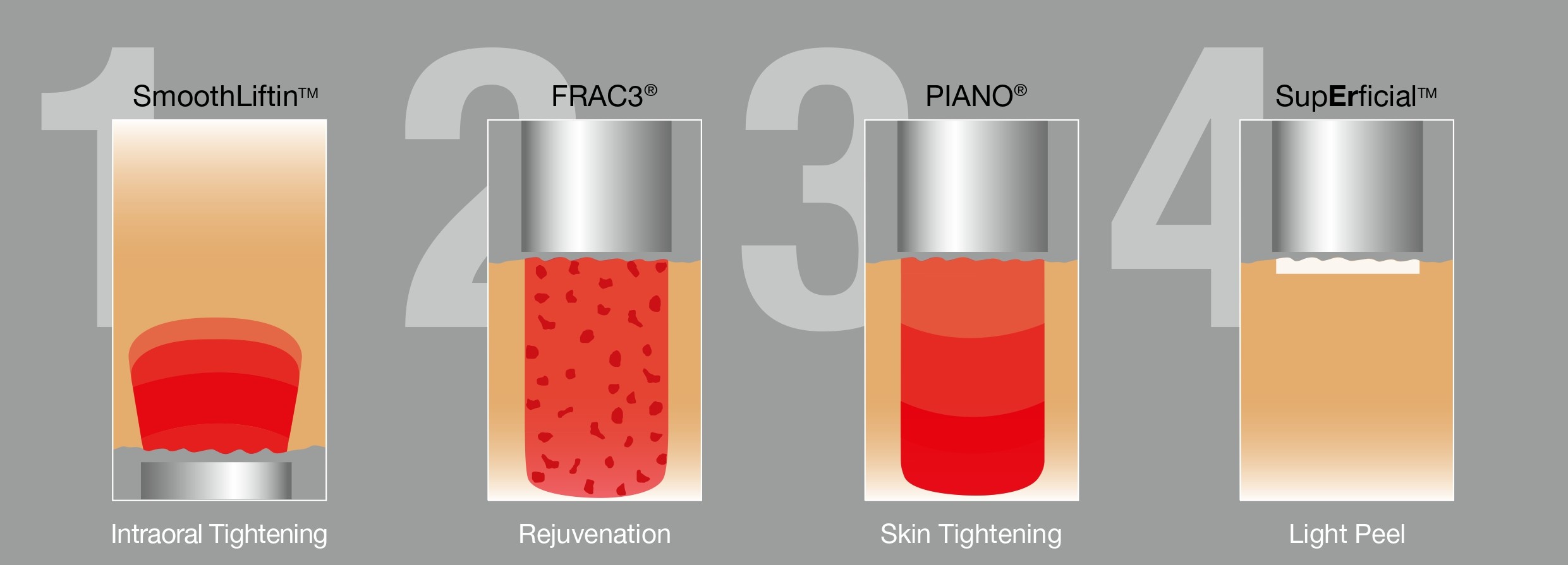 The Four Dimensions of Fotona 4D
